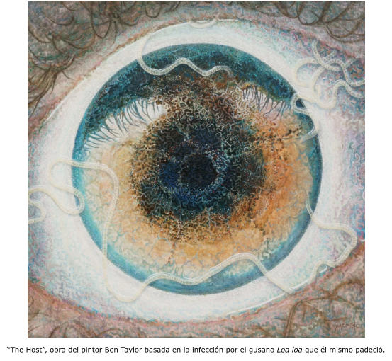 “The Host”, obra del pintor Ben Taylor basada en la infección por el gusano Loa loa que él mismo padeció.